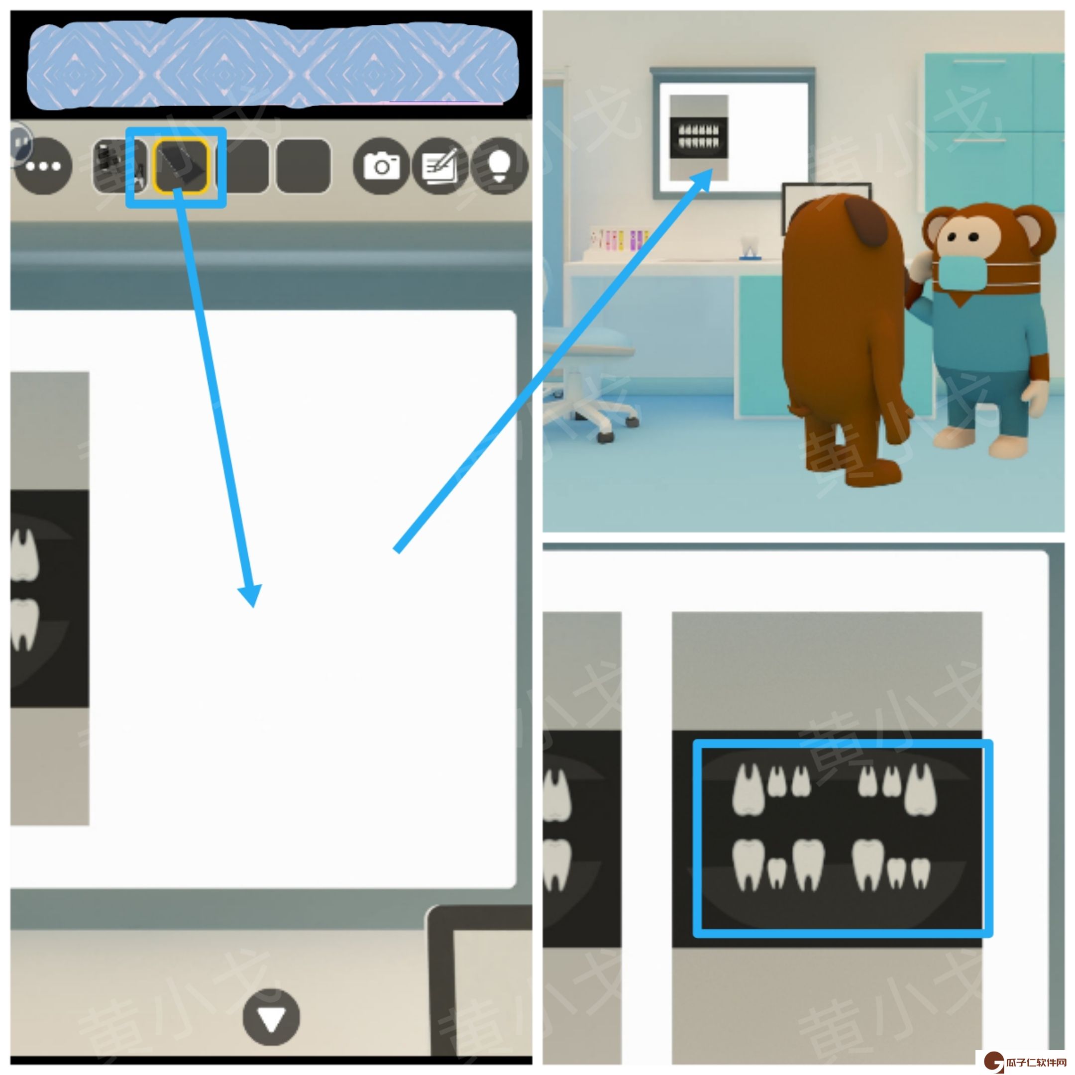 Escape Room：Dental（密室逃脱：牙科诊所）攻略（二）