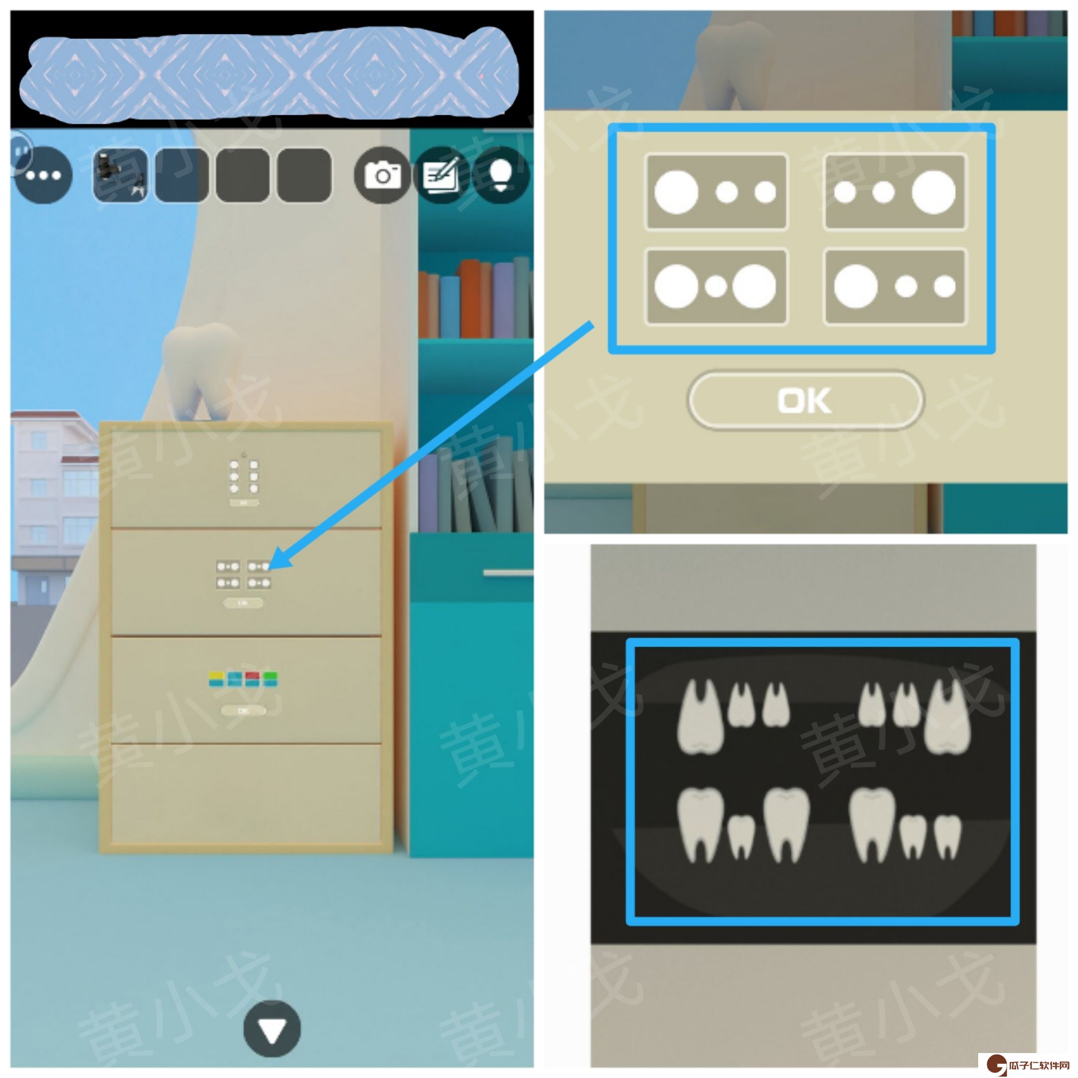 Escape Room：Dental（密室逃脱：牙科诊所）攻略（二）
